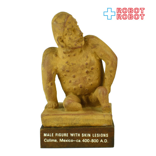 皮膚病変の男性 医薬品メーカー陶器スタチュー